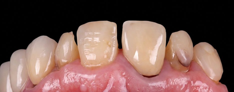 Before treatment